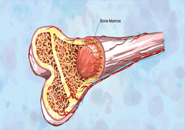 bone-marrow-transplantion